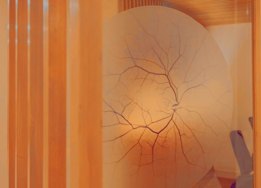 Open Angle Vs Angle Closure Glaucoma What S The Difference