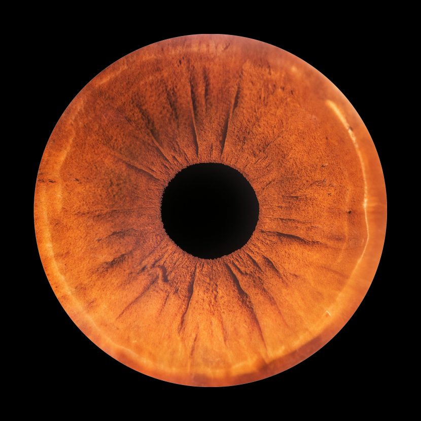 glaucoma and diabetes connection