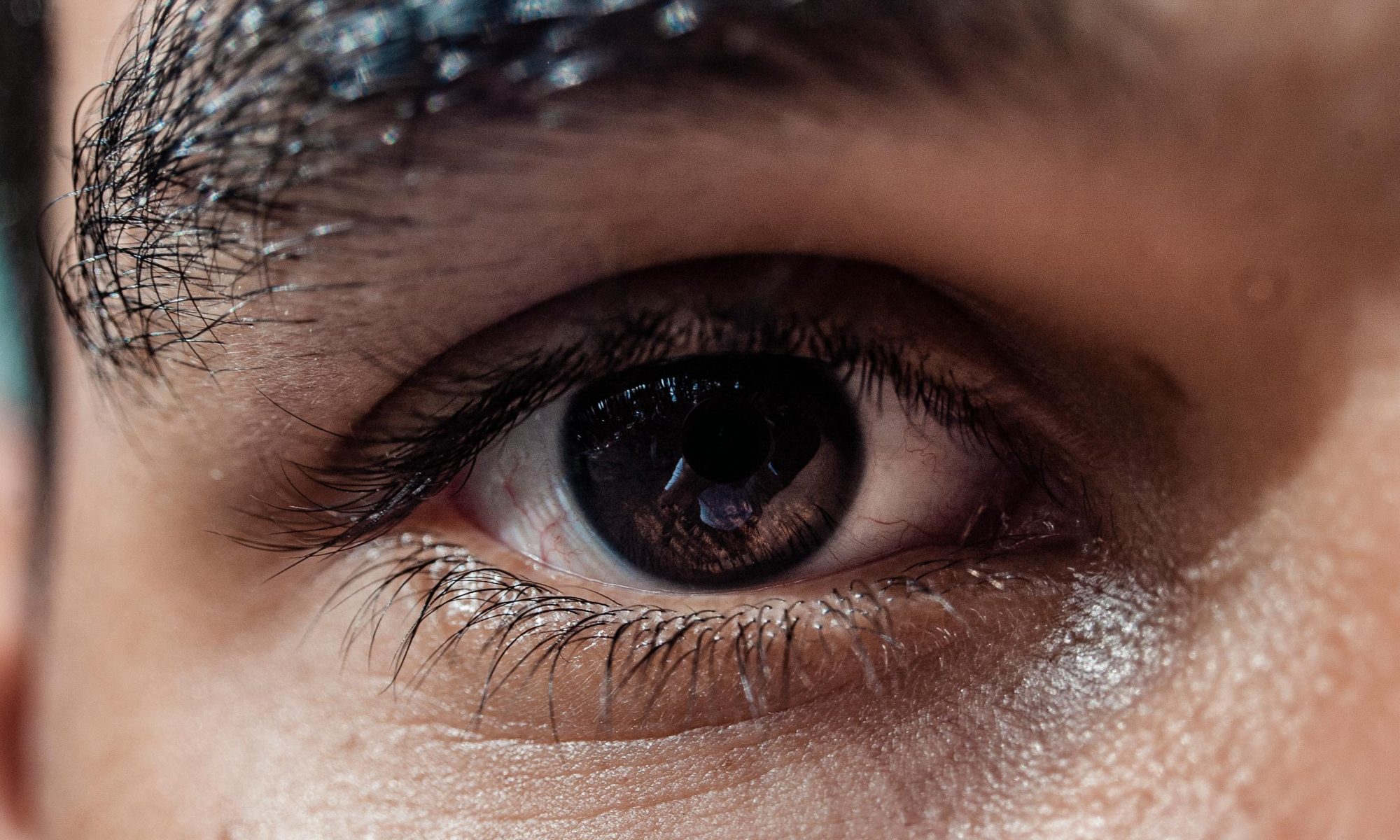 open angle glaucoma vision loss